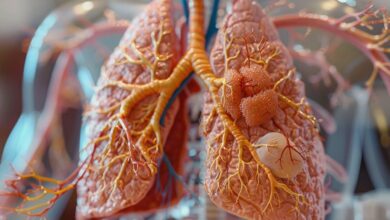 Symptômes et prévention de l'embolie pulmonaire : guide pour protéger votre santé